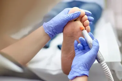 Zdrowe stopy Podologia Olsztyn - wrastające paznokcie-grzybica paznokci-brodawki wirusowe -odciski-modzele